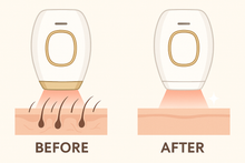 Cargar imagen en el visor de la galería, Depiladora Laser - PulsLed
